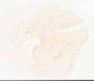 ['deident_600e8a72-474d-460b-bbc0-3a6b04ab2d45_69d93ed0.jpg']