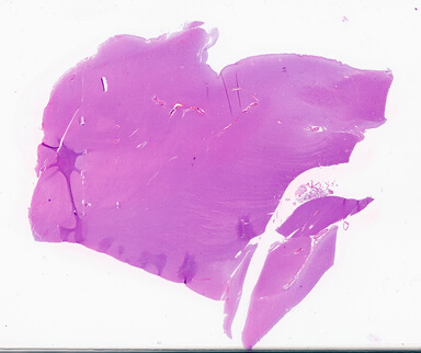 ['deident_50e9ea2c-975c-4ea7-bea1-bc255d11482c_69d94cfb.jpg']