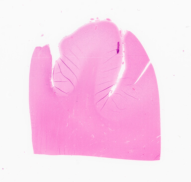 ['deident_811c1320-f1e5-473e-b141-e7df5ecaa2a6_69d953eb.jpg']