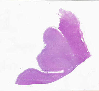['deident_0741c1ae-6af4-4de2-9180-5999985ce1fc_69b0605c.jpg']