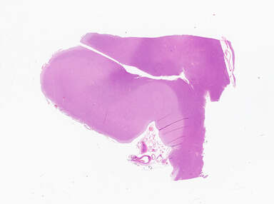 ['deident_dfb4ee1d-31ee-4d59-9107-60a6b54d891f_69b0658a.jpg']