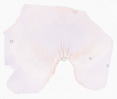 ['deident_3160a37a-1c70-414e-8888-b169424e742f_69d96bd4.jpg']