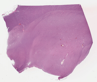 ['deident_00d91fa6-2a01-4578-97fe-72cd26c8c831_695fcb36.jpg']