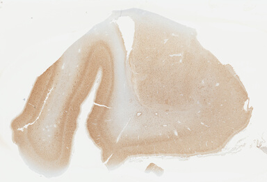 ['deident_6a6d7a4f-3bc2-49e6-9b59-95dc4a7564ed_695fcb4f.jpg']