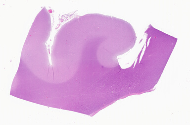 ['deident_b892a9f5-0c67-43a3-8048-f34a47dbf321_69b06271.jpg']