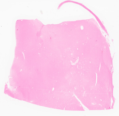 ['deident_be87f895-ae33-4d5f-a9d8-486afeaec191_69d960ab.jpg']