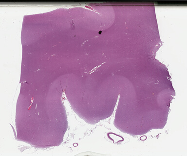 ['deident_db0b9fae-a69b-4050-b766-3a1ebd96e8a7_69b04f77.jpg']