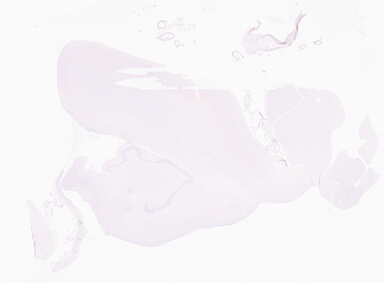 ['deident_dea47424-a7d3-48df-91c0-81864fe7c483_69d95d4a.jpg']