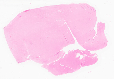 ['deident_66f79c92-f160-46bf-a4e7-6c9a08e0b90f_69d95cfa.jpg']