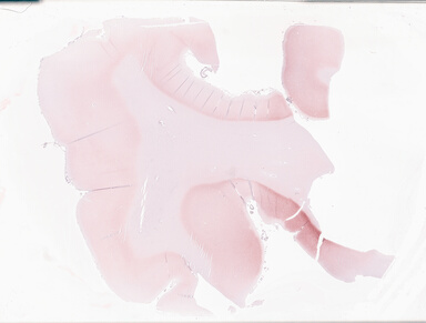 ['deident_9a8764e0-2820-425a-9a88-4b2fbd4fff18_69b02d94.jpg']