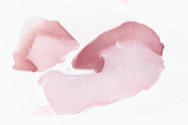 ['deident_deb60af7-156a-4769-9d54-a78748883fbc_69b02dbc.jpg']