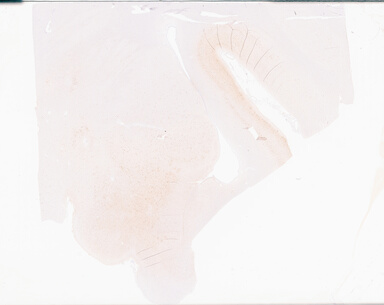 ['deident_145febdb-23a6-42c6-bb62-5b23049b18fd_69b05df2.jpg']