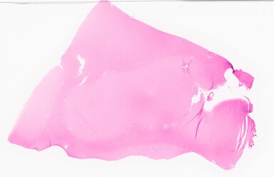 ['deident_a1b0c0da-1478-483a-b0ee-976e83de613f_69d958ef.jpg']