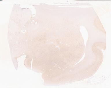 ['deident_1a97e9c2-687c-4f05-83f8-c321a09c9267_69b054fa.jpg']