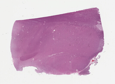 ['deident_6554b3e5-efdb-4bd1-ab02-df339efcf65a_69b02f65.jpg']
