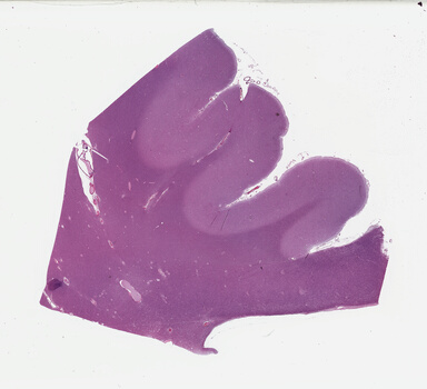 ['deident_e7861e69-9a43-452c-955f-047e598d1607_695fd54b.jpg']