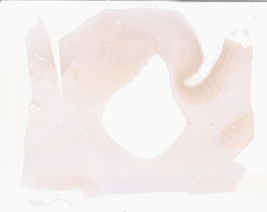 ['deident_d616fa55-4c45-444f-b7e4-a9db2681e1be_69b05596.jpg']