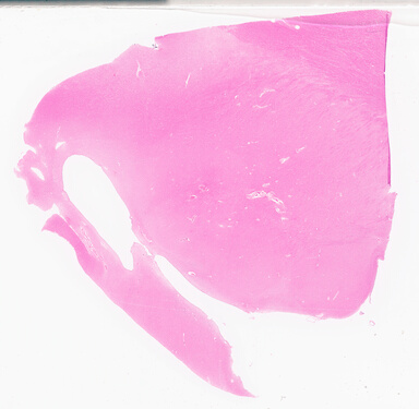['deident_6f1ca6a4-1828-492b-aa30-80b423004940_69d95e34.jpg']