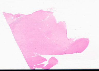 ['deident_2ec6d165-b725-4281-94c9-e02064d11850_69d9512d.jpg']