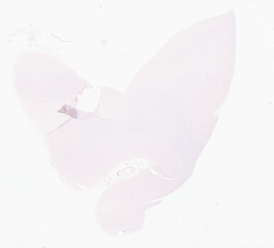 ['deident_c0612cbd-33cc-45f6-8a3f-fd6a80b037e8_69d968c7.jpg']