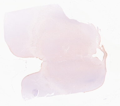 ['deident_018eab56-acc5-4634-bc08-7c042ad4d836_69d96852.jpg']
