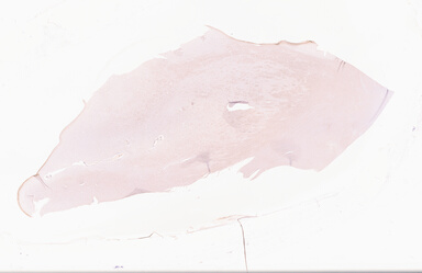 ['deident_666c15c3-bad8-4612-b67e-8e9729b1fe6b_69d9689a.jpg']