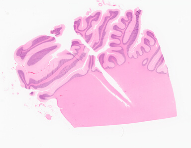 ['deident_85f018ff-83fe-4a15-8ef6-a0e1027eee71_69d968af.jpg']