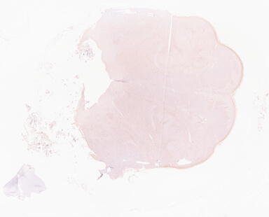 ['deident_c9f35445-cd25-43e6-b31b-f693c679d3df_69d968cf.jpg']