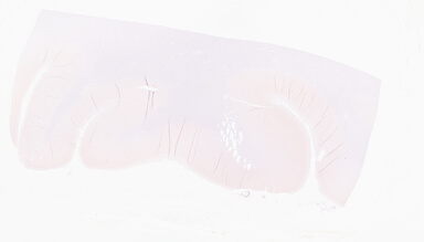 ['deident_eb0bd3b5-ed8b-4418-bfce-28c719c0f013_69d968de.jpg']