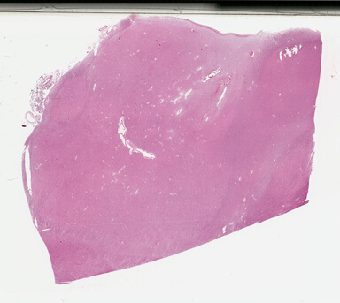 ['deident_cb70cde3-6441-4ed1-8c68-2bf900b25247_695fcedd.jpg']