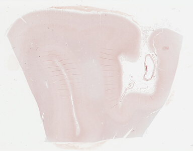 ['deident_ab77dbfb-2b3c-4c69-8edd-4aa66638520b_695fced6.jpg']