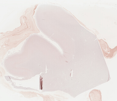 ['deident_0f8895ff-6b42-482f-98da-6d972c64aa46_695fce92.jpg']