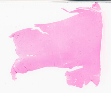 ['deident_7d006ad4-25f5-476a-b16a-9d476d693695_69d94e20.jpg']