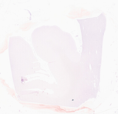 ['deident_a79a6999-02cf-48d9-bf7a-3e4f8578648e_69d94e30.jpg']