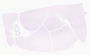 ['deident_060c6a38-9e1f-46ec-8b62-7475fea1f205_69d95c2e.jpg']