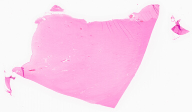 ['deident_1df6d386-68f0-4bbf-ba63-38d48f3fac41_69d95c42.jpg']