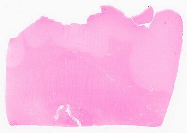 ['deident_bdf4a292-e582-4f15-bd64-8d6c5f022469_69d95b79.jpg']