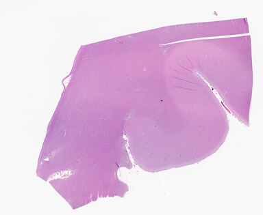 ['deident_86adb685-2496-4c1d-8878-791c40ac9004_69d942dc.jpg']