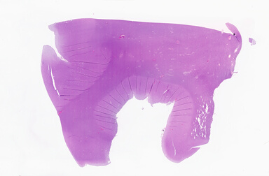 ['deident_c6d5426f-7453-41f1-b9a2-78de358b7811_69b05c3c.jpg']