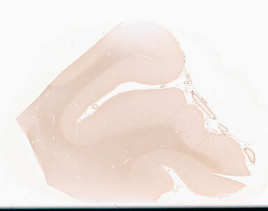 ['deident_28130827-7fae-492f-8eb8-aebc34387f10_695fcb8f.jpg']
