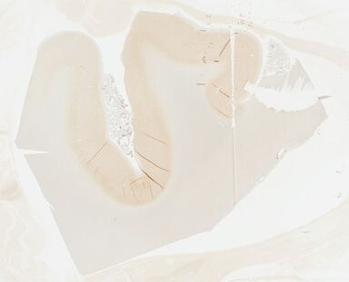 ['deident_19c8e272-804c-4762-9ad5-a90313fcf9fd_695fcae0.jpg']