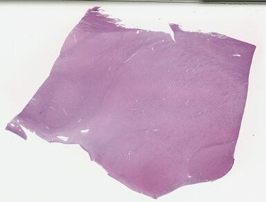 ['deident_87b6c219-6de2-4d51-848c-7511c2c60309_695fcb05.jpg']