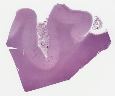 ['deident_b362f0d8-5bcd-481a-916f-b1f05cc98656_695fcb25.jpg']