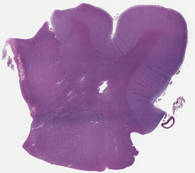 ['deident_77184490-de62-4baf-8368-016982688761_69b0294d.jpg']