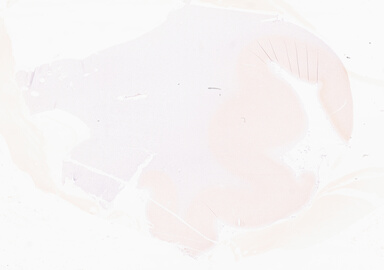 ['deident_6832e943-5c8a-43dc-a635-1810a3d5972f_69d962eb.jpg']