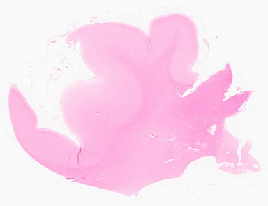 ['deident_ec3bdcc3-96a8-4151-8f25-39951e960448_69d9633e.jpg']