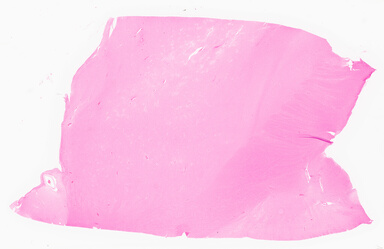 ['deident_8becfe7e-e6d5-44fb-bbe7-5ef0e150df39_69d9630a.jpg']
