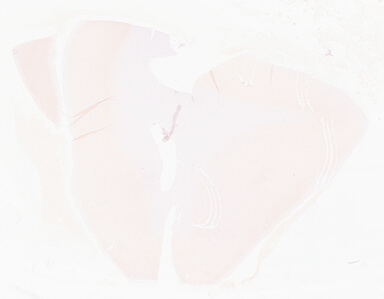 ['deident_777e1b2c-45e1-4a78-8a2c-af82a6e44f48_69d962fb.jpg']
