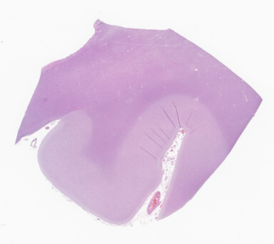 ['deident_42db16e0-058b-47ed-a179-c4c2e14f1e90_69d9424f.jpg']