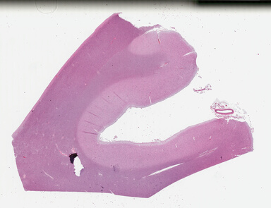 ['deident_4a0ac1f7-216e-4bf8-8c0e-44062e7cf0b9_695fd203.jpg']